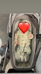 Baby growing out of bassinet at 3 months?