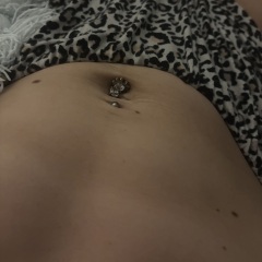 Diastasis recti?- pics attached