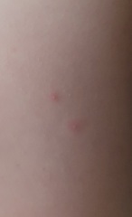 What are these spots?