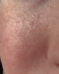 Skin concern