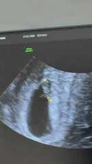 Anyone any good at ramzi?