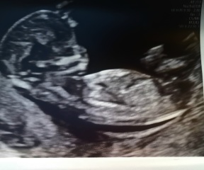 Gender Guesses?