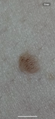 Mole