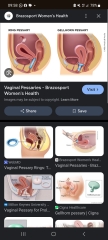 Please tell me about your ring pessary!! Is this normal?