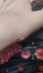Is this a wart or should I see a doctor?