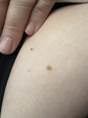 Mole