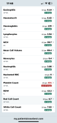 High platelets - can anyone interpret these results?