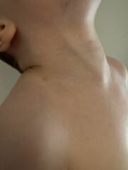 Is This Chicken Pox?