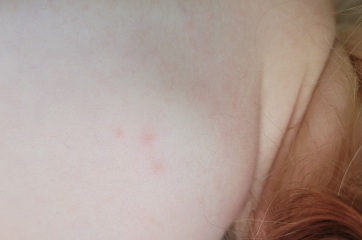 What are these spots?