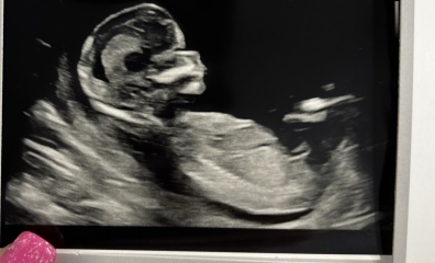 Gender prediction?