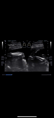 20 weeks any clues?