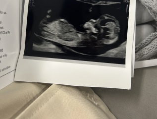 Gender prediction?