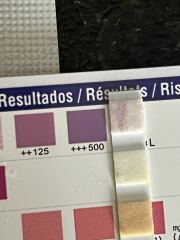 Urine test