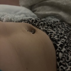 Diastasis recti?- pics attached