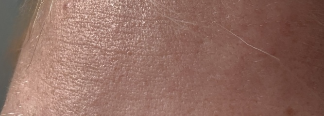 Skin concern