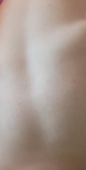 What are these spots?