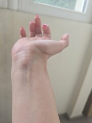 Lump in the inside inner part of wrist