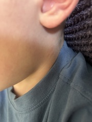 What are these spots on my son’s skin?