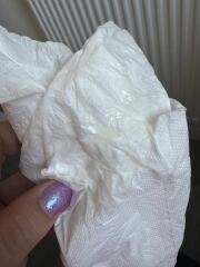 Mucus plug or normal pregnancy discharge 37+4