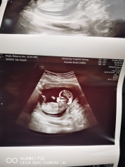 Any guesses nun boy or girl