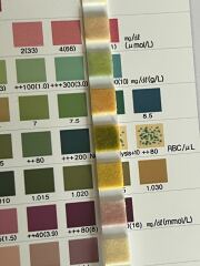 Urine test