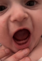 Will his teeth come through anytime soon?