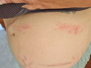 Under boob sweat chaffing 🫣