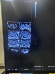 Bit of fun ramzi theory for curious boy mum of two pregnant with baby 3!