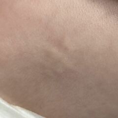 13w old has lumps on her back