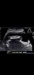 20 weeks any clues?