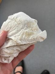 ? Bleeding in early pregnancy ? Chemical pregnancy