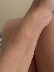 Really worried, grateful of opinions please!
