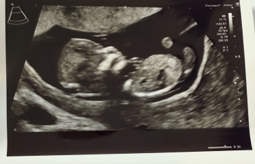 Nub / Skull theory guesses