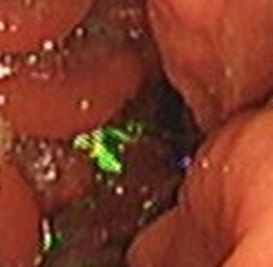 2 year old daughter swallowed a 50p coin !!!