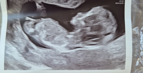 Gender Guesses?