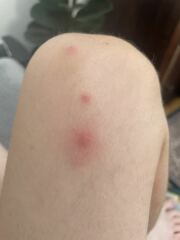 What are these spots on my DD?