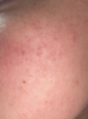 What is wrong with my skin😔 pics included
