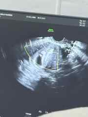 Anyone any good at ramzi?