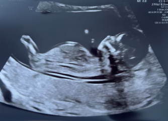 Boy or girl gender guesses 12+4
