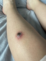 Does this look like skin cancer?