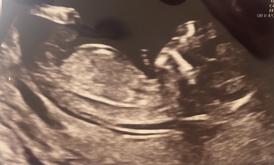 Boy or girl gender guesses 12+4