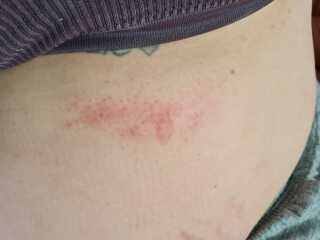 Under boob sweat chaffing 🫣