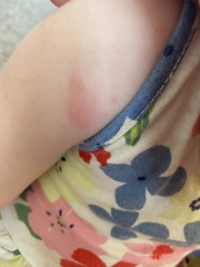 What does this look like?