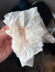 Implantation? Clots?