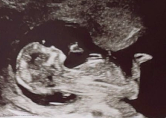 Boy or girl?