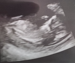 Gender guesses please