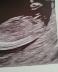 Gender Guesses?