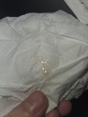 Implantation or period?