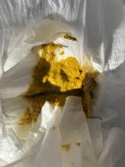 Could this possibly be CMPA? *TMI picture of baby poo