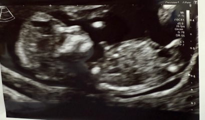 Nub / Skull theory guesses